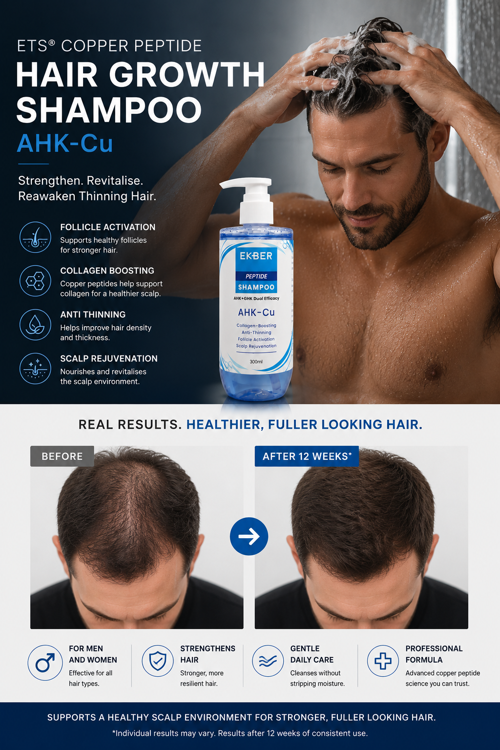 Copper Peptide Hair Growth AHK-Cu Shampoo 300ml