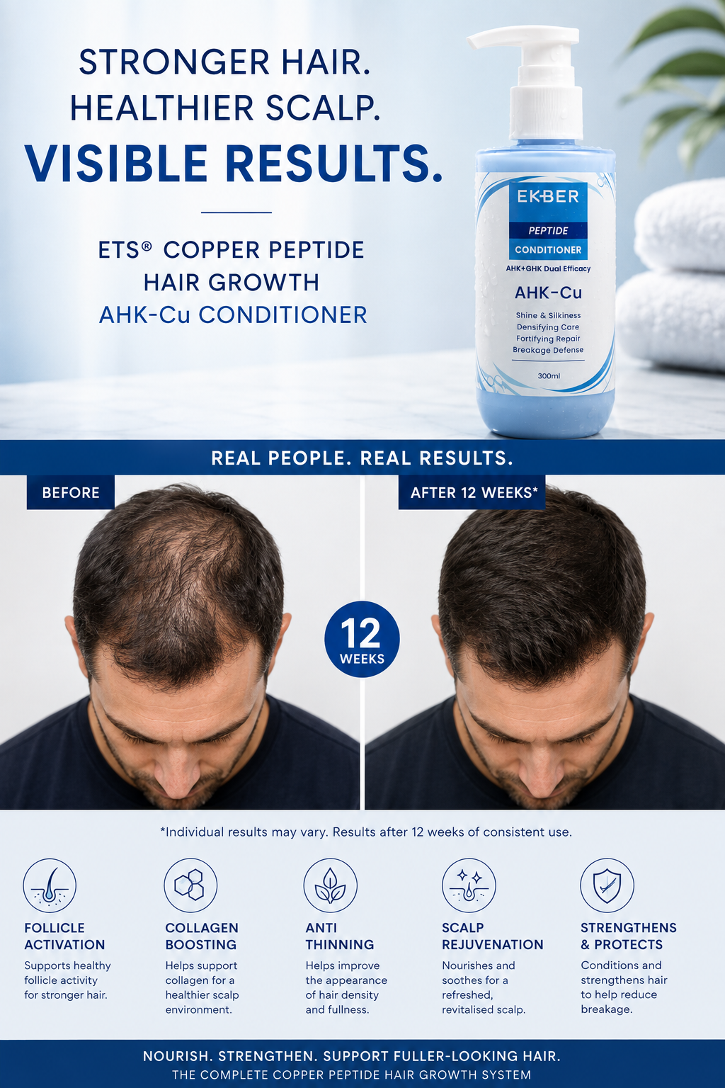 Copper Peptide Hair Growth Conditioner – AHK-Cu 300ml
