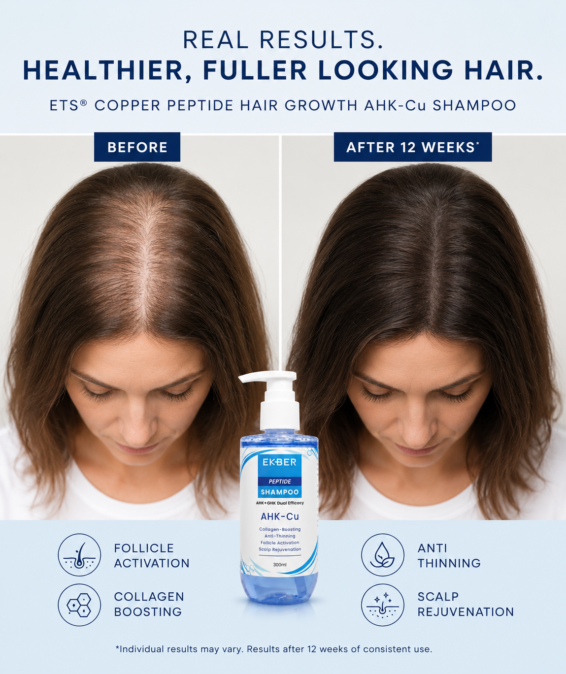 Copper Peptide Hair Growth AHK-Cu Shampoo 300ml